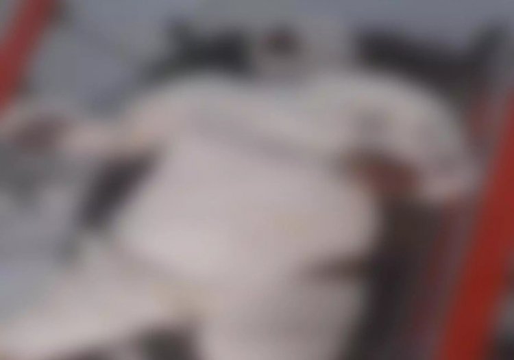 रायपुर आग में जलती हुए युवती पहुंची रेलवे स्टेशन, हालत गंभीर