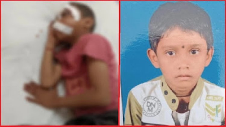 गंभीर हालत में मिला स्कूल के लिए निकला बालक, चोट के कई निशान, एक आंख फोड़ गोंद डालने का प्रयास, हालात नाजुक