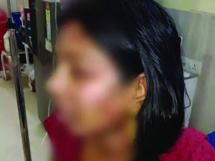 रायगढ़ 250 रुपए के लिए पत्नी के ऊपर पति ने फेंका खौलता हुआ गर्म दाल