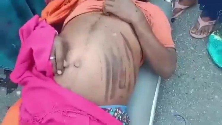 Jharkhand 50 रुपए नहीं देने पर ड्राइवर की बेरहमी से हत्या, ASI पर लगा हत्या का आरोप